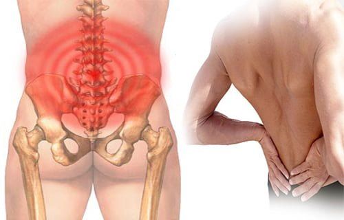 Đau mỏi ngang thắt lưng là bệnh gì! Nguyên nhân, triệu chứng và cách chữa trị hiệu quả